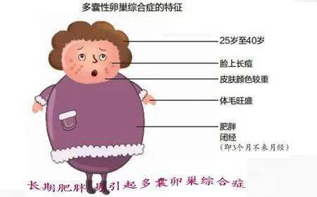 肥胖最招惹婦科疾病，你知道嗎？