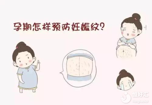 預防妊娠紋用這些小妙招，美麗離你更近一步！