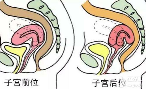 子宮后位很難懷孕嗎？醫生：掌握這兩點輕松受孕