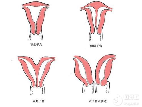 子宮偏小能懷上寶寶嗎？看完或許會(huì)嚇一跳