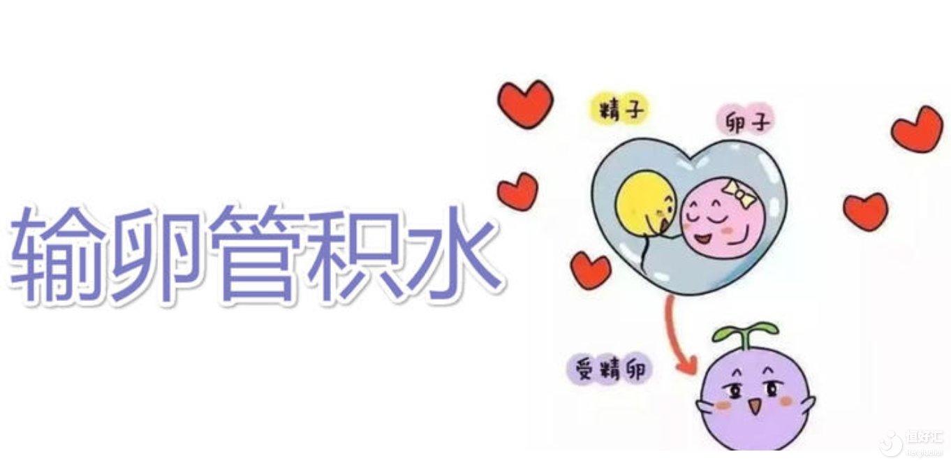 試管嬰兒輸卵管積水怎么辦？這樣做輕松解決！