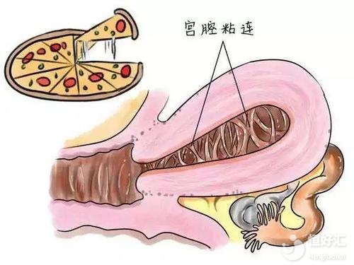 大齡做試管嬰兒也許有這些好處，很多人都忽略了！