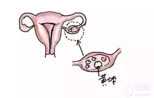 卵巢破裂應該如何調理？醫生：飲食調理或許有效