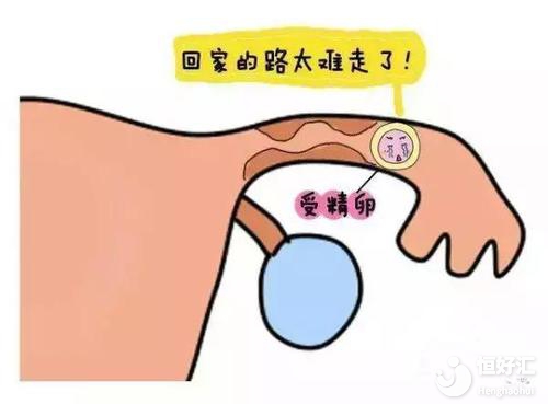 懷孕是開心的事兒，但也要特別留意宮外孕！