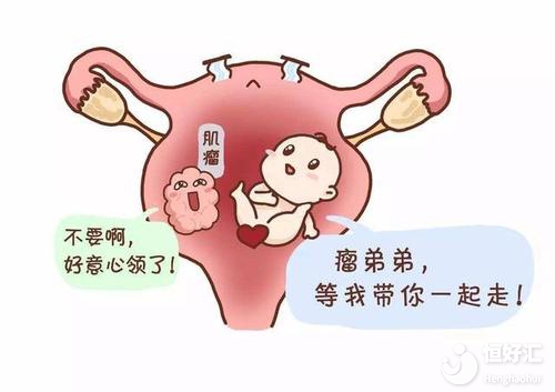 看完這篇文章，遇到復發率高的子宮肌瘤也不要怕！