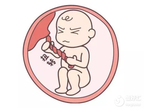 這樣做容易加重胎兒臍帶繞頸，孕媽媽們注意了！