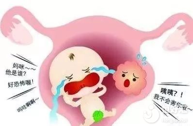 子宮肌瘤和懷孕能否共存？看完這個秒懂！