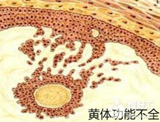 女性不易懷孕很可能是黃體功能異常，你有嗎？