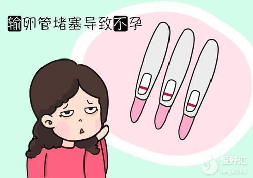 不孕不育有這4大原因，你全都占了嗎？