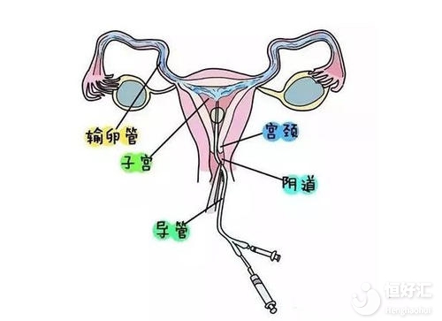 不孕檢查的最佳時間你知道嗎？快看這里