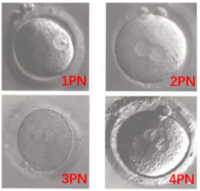 醫(yī)生常說的：2PN、0PN、1PN是什么意思？有什區(qū)別？
