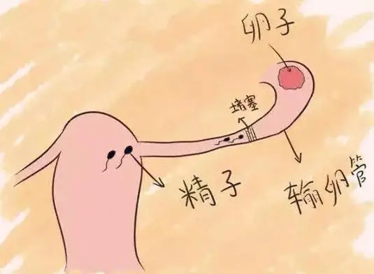 輸卵管堵塞，中醫(yī)的辨證分型有哪些？