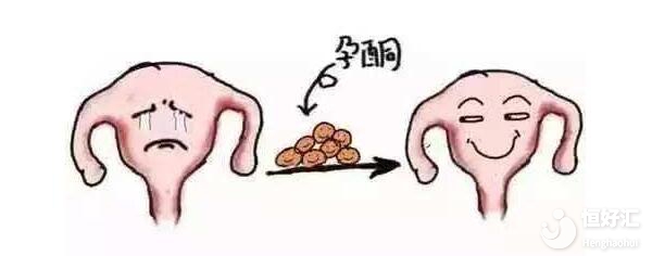 試管嬰兒知識(shí)：孕酮高了就不能移植嗎？
