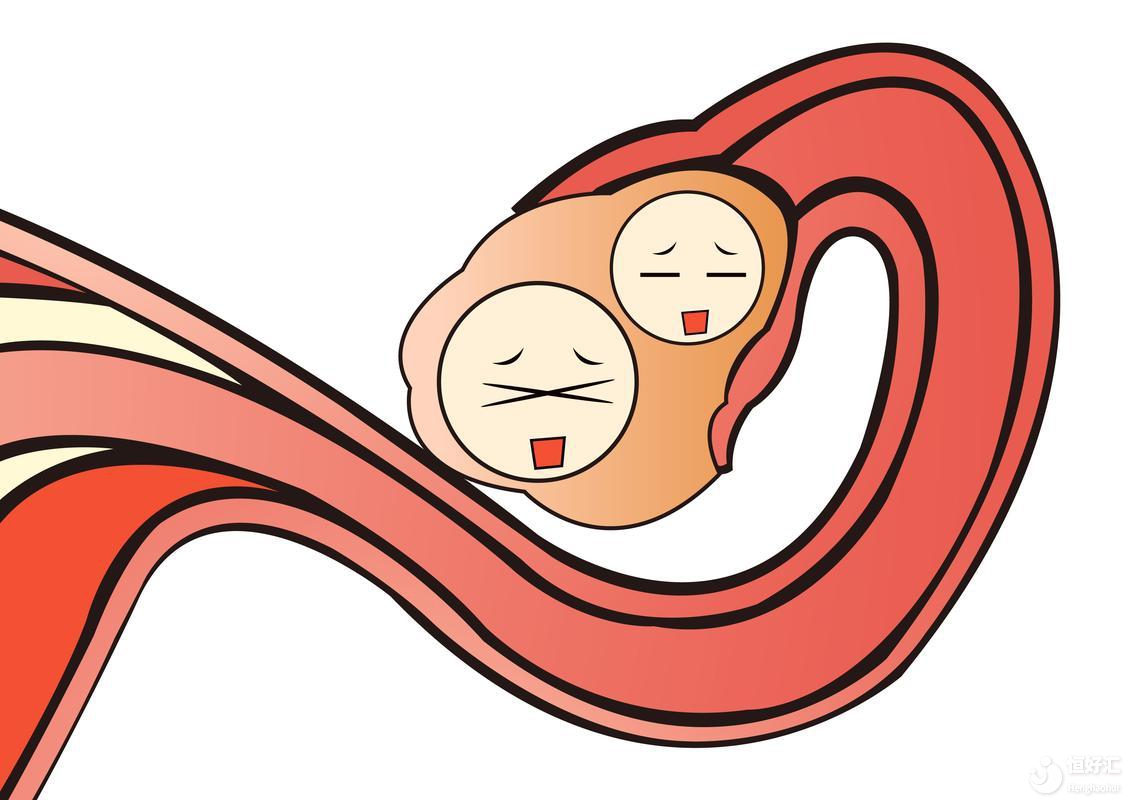 試管嬰兒移植失敗？你必須了解的黃體支持知識